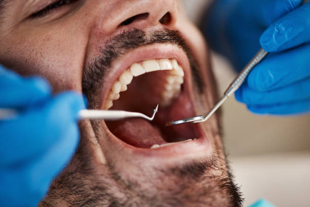 Best Pediatric Emergency Dentist in Ashville, OH