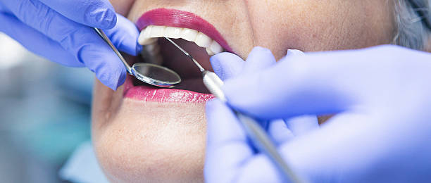Best Emergency Dentist for Lost Fillings or Crowns in Ashville, OH